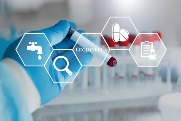 Legionella,Test,Medical,Concept.,Bacteria,In,Human,Lungs,Diagnosis,Causative